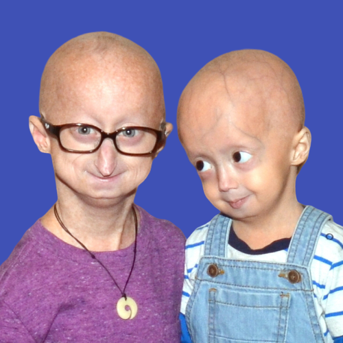progeria premature aging