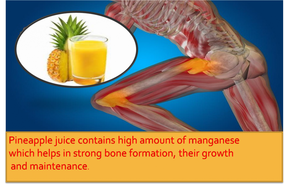 health benefits of pineapple juice on bone