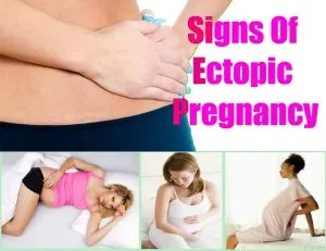 ectopic pregnancy